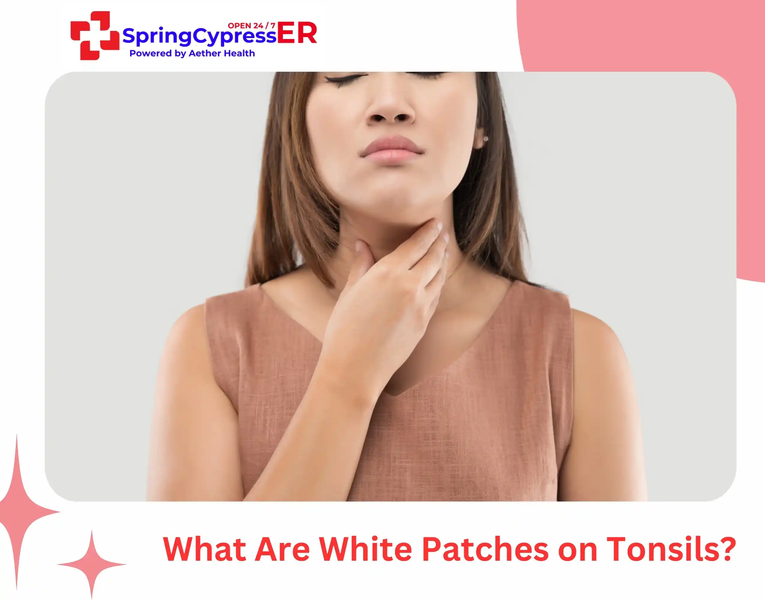 What Are White Patches on Tonsils