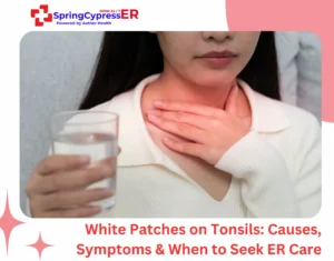White Patches on Tonsils Causes, Symptoms & When to Seek ER Care