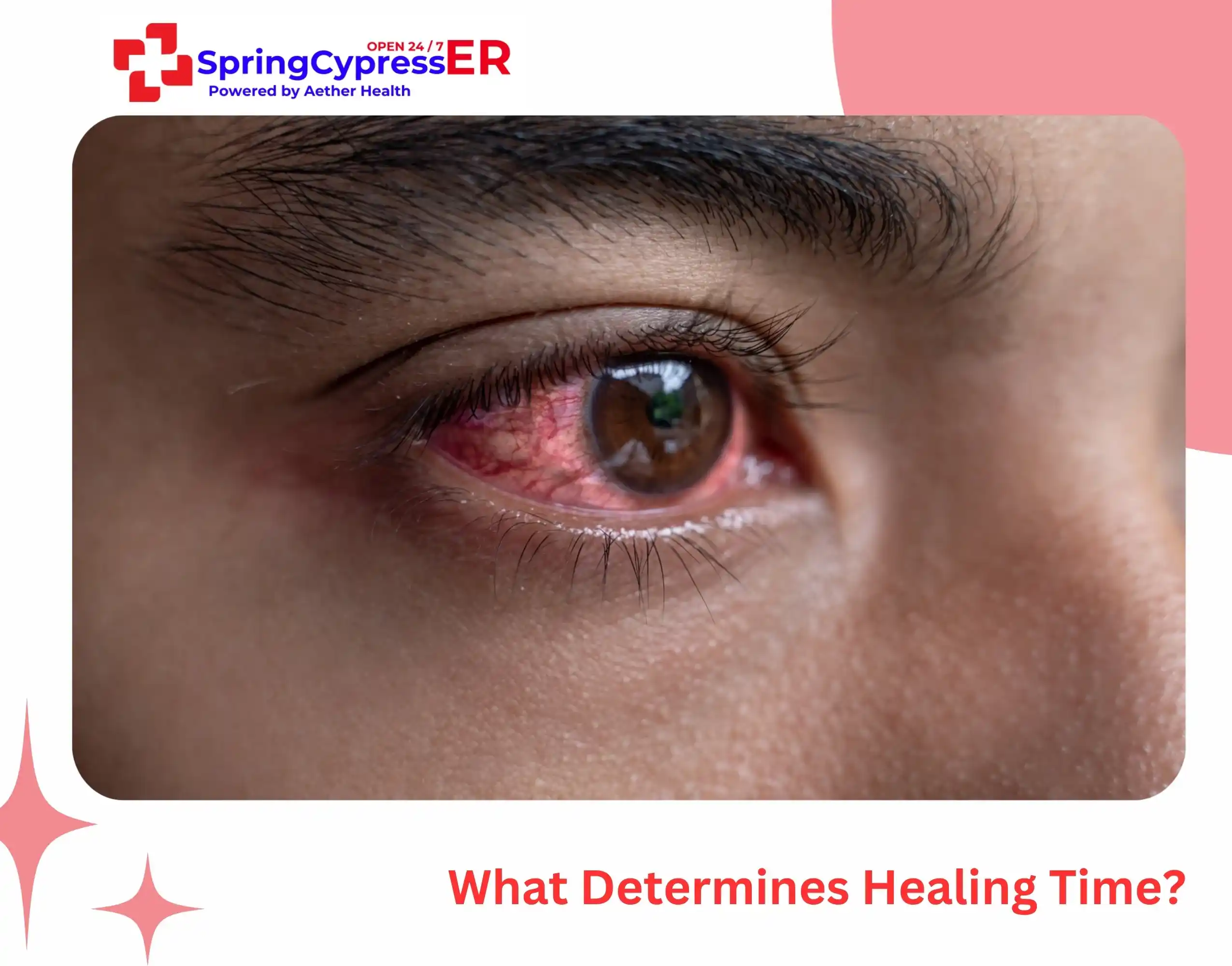 What Determines Healing Time