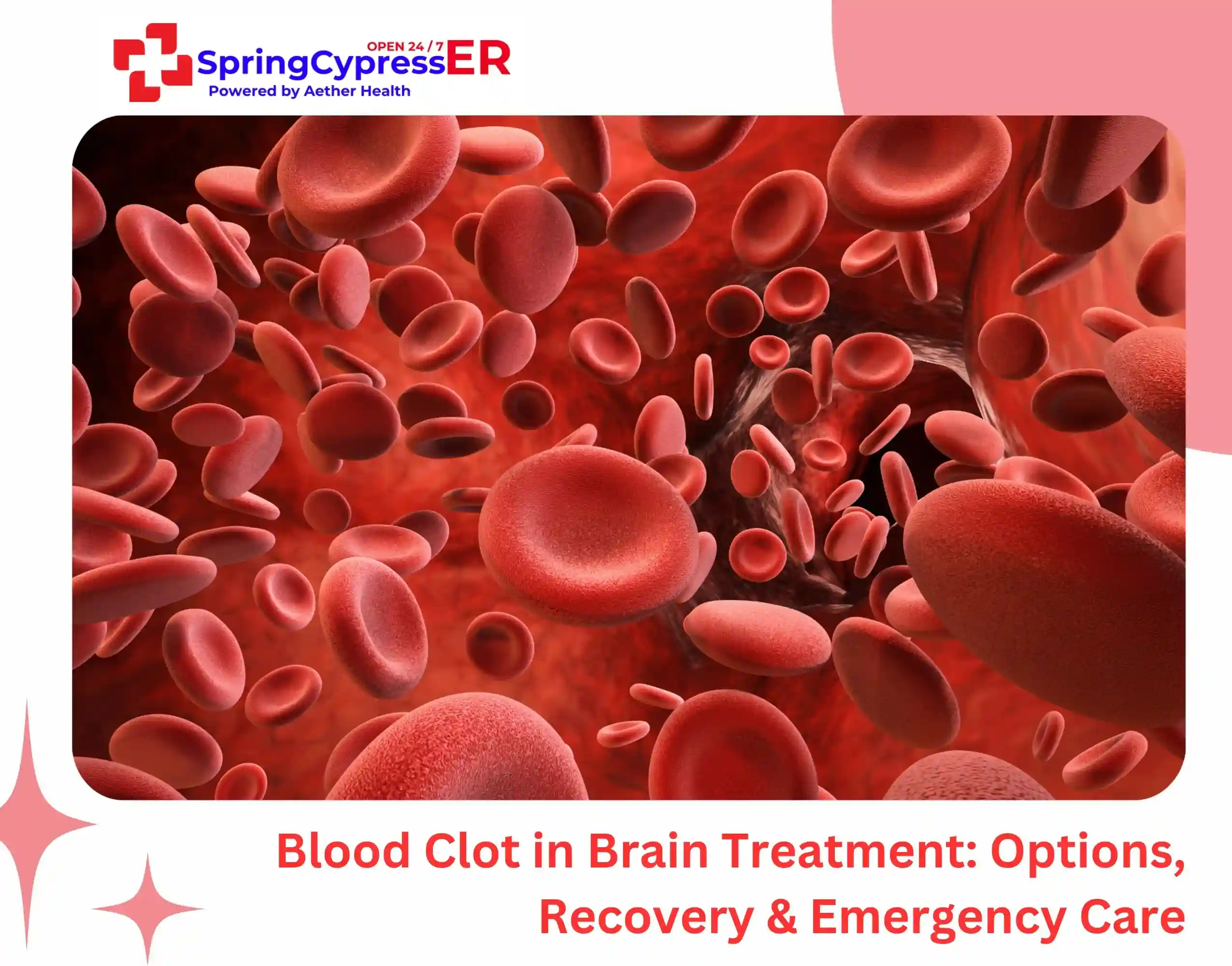 Blood Clot in Brain Treatment Options, Recovery & Emergency Care