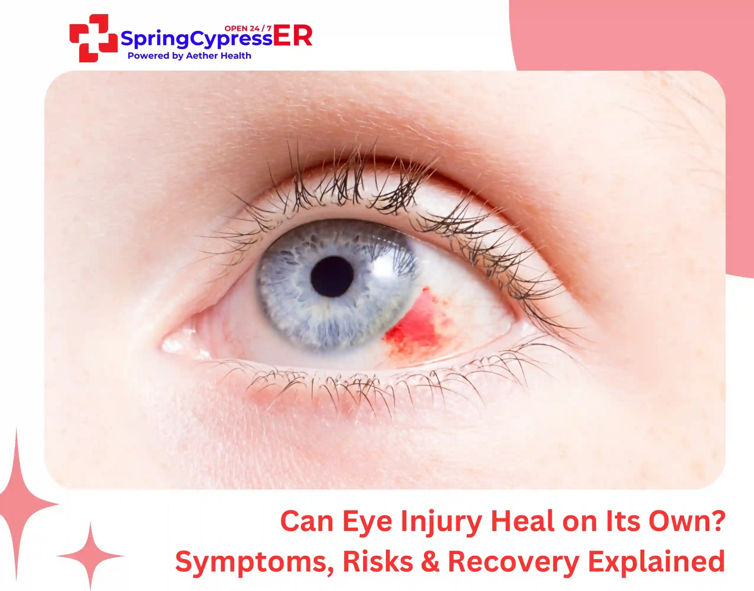 Can Eye Injury Heal on Its Own Symptoms, Risks & Recovery Explained