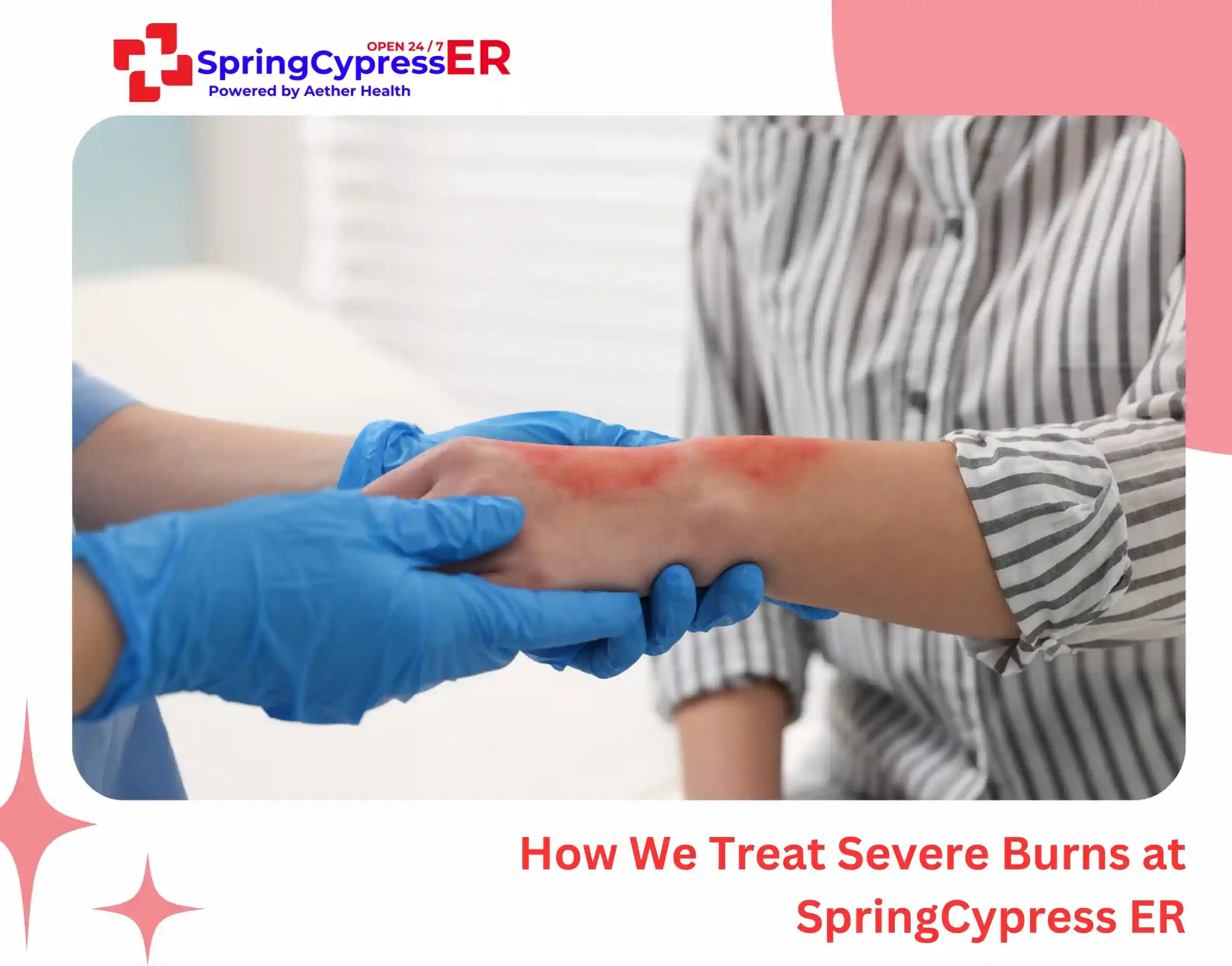 How We Treat Severe Burns at SpringCypress ER