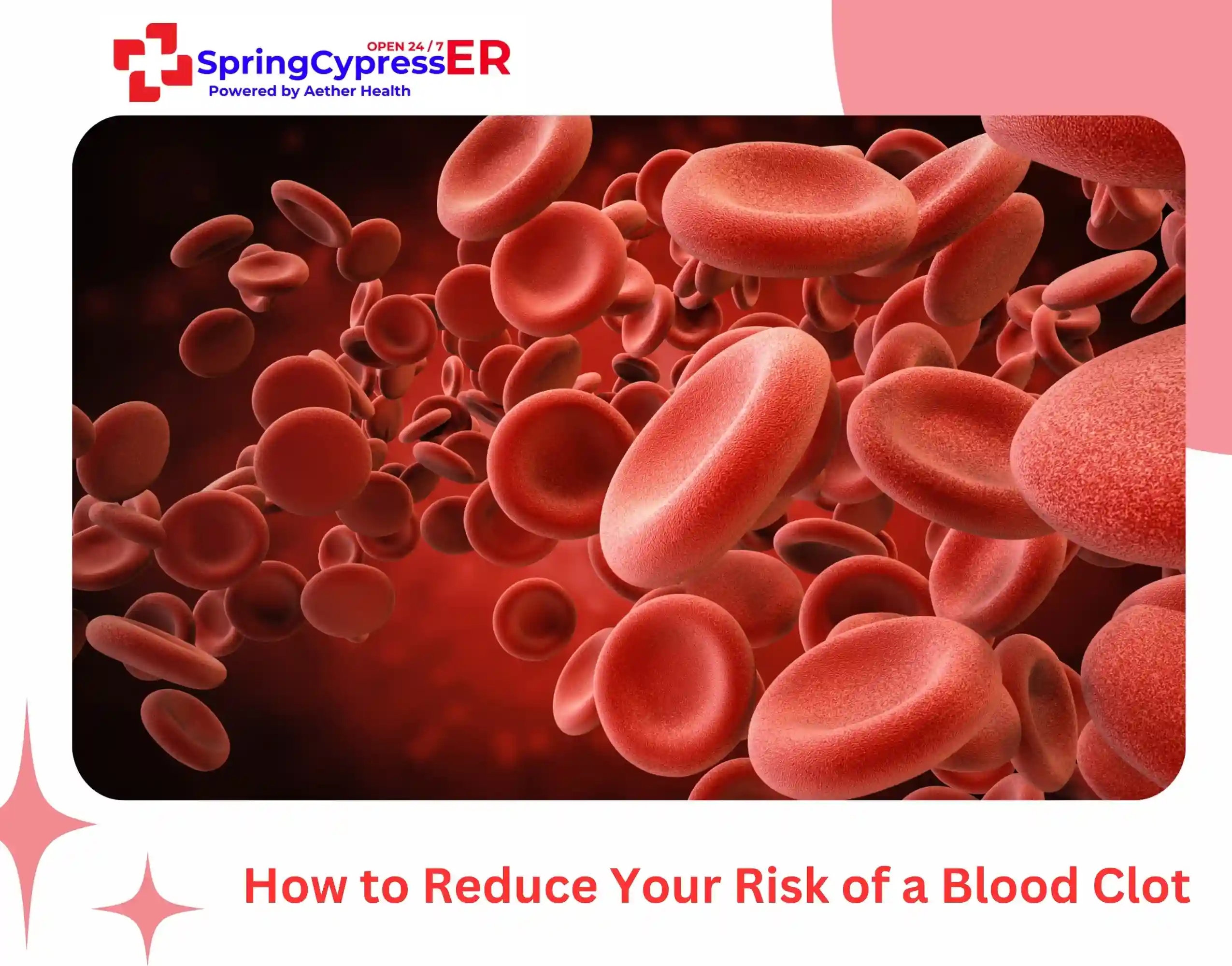 How to Reduce Your Risk of a Blood Clot