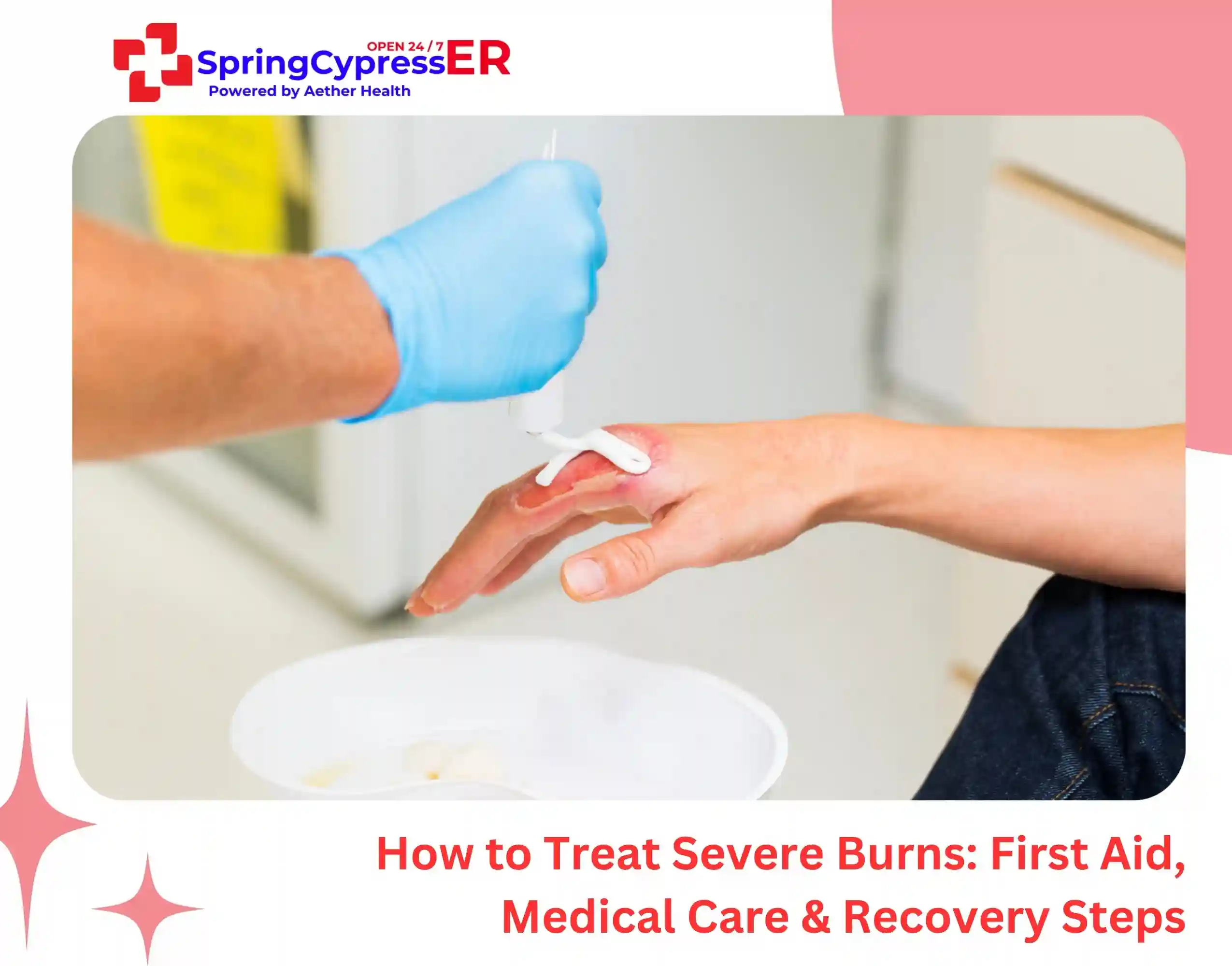 How to Treat Severe Burns First Aid, Medical Care & Recovery Steps