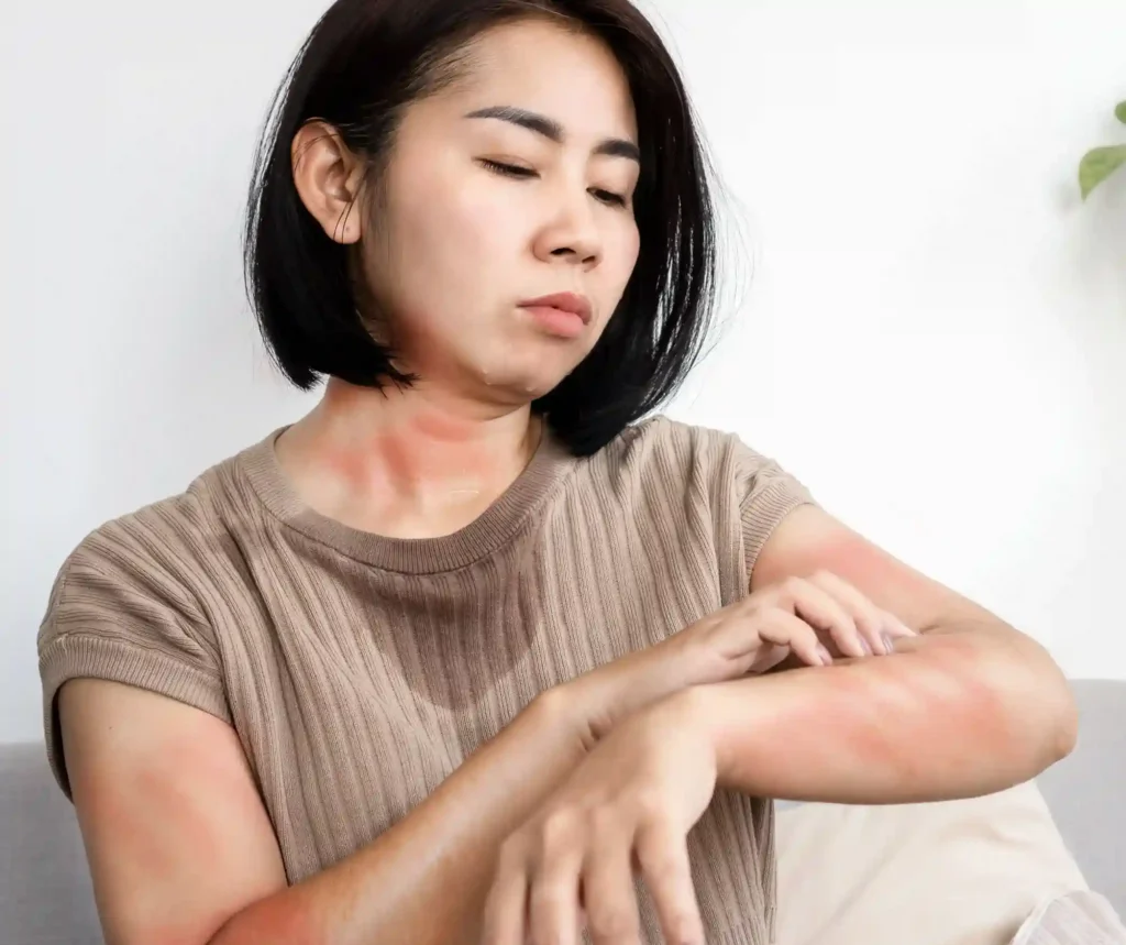 24/7 Emergency Room for Allergy Spring Cypress, Rashes