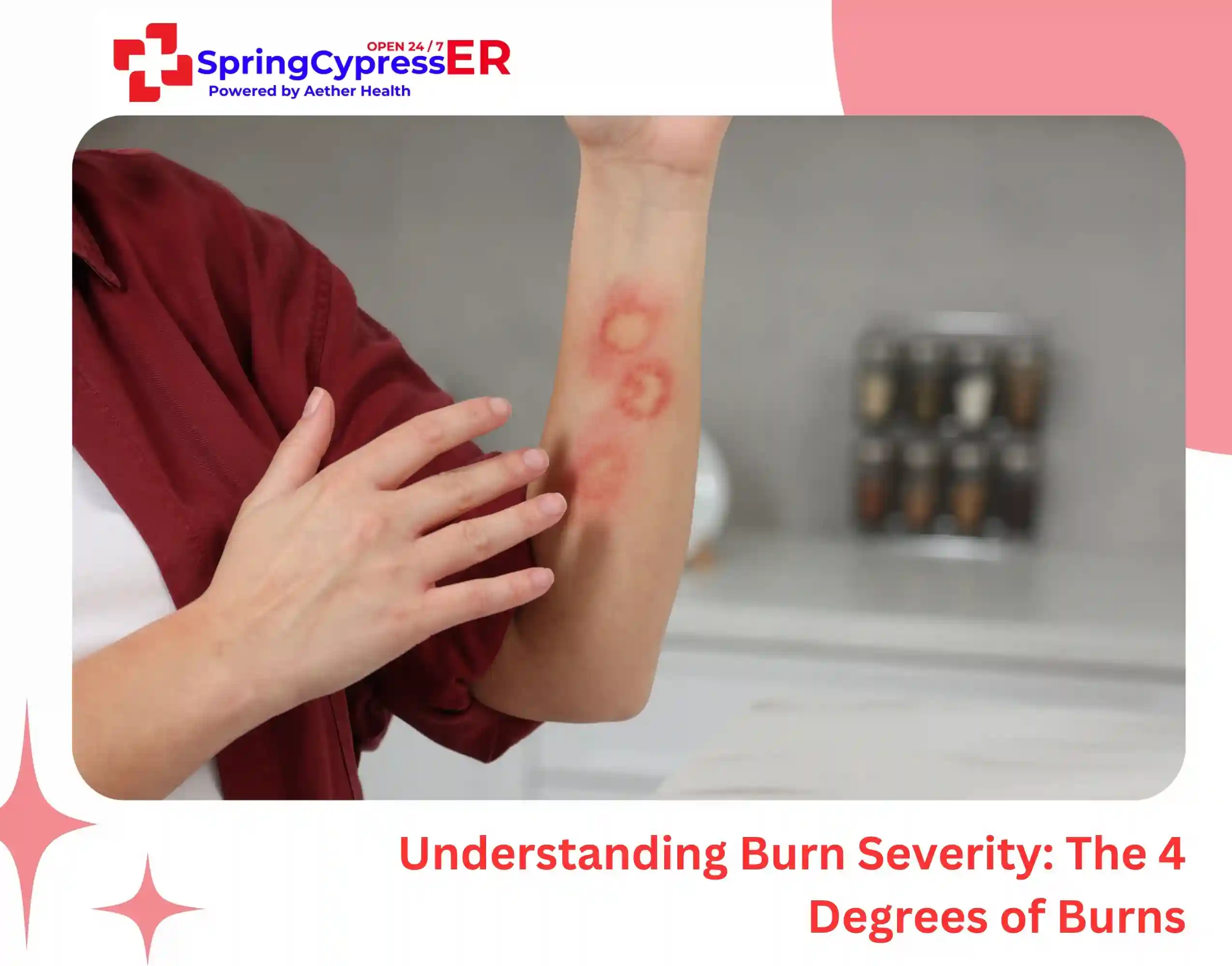Understanding Burn Severity The 4 Degrees of Burns
