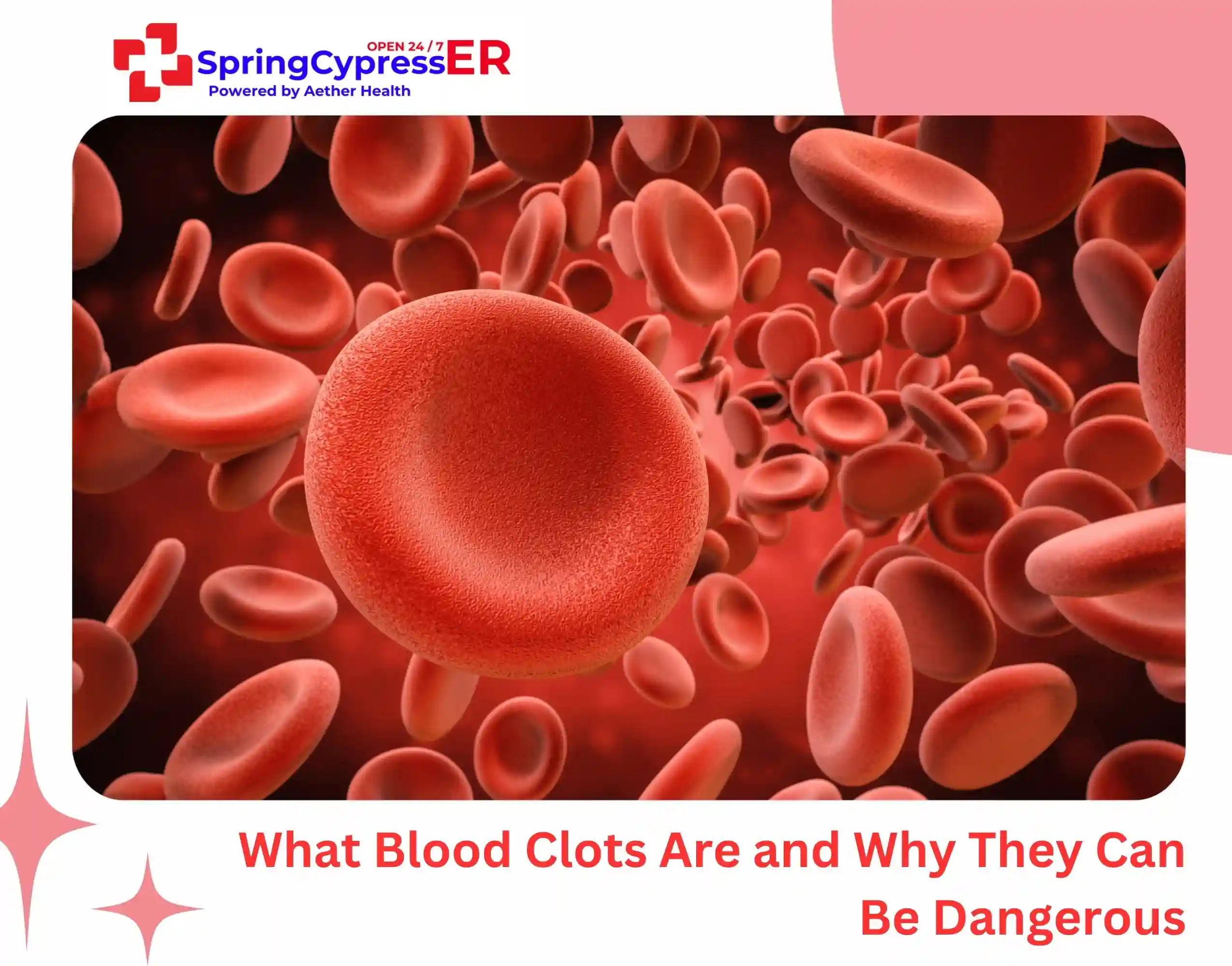 What Blood Clots Are — and Why They Can Be Dangerous