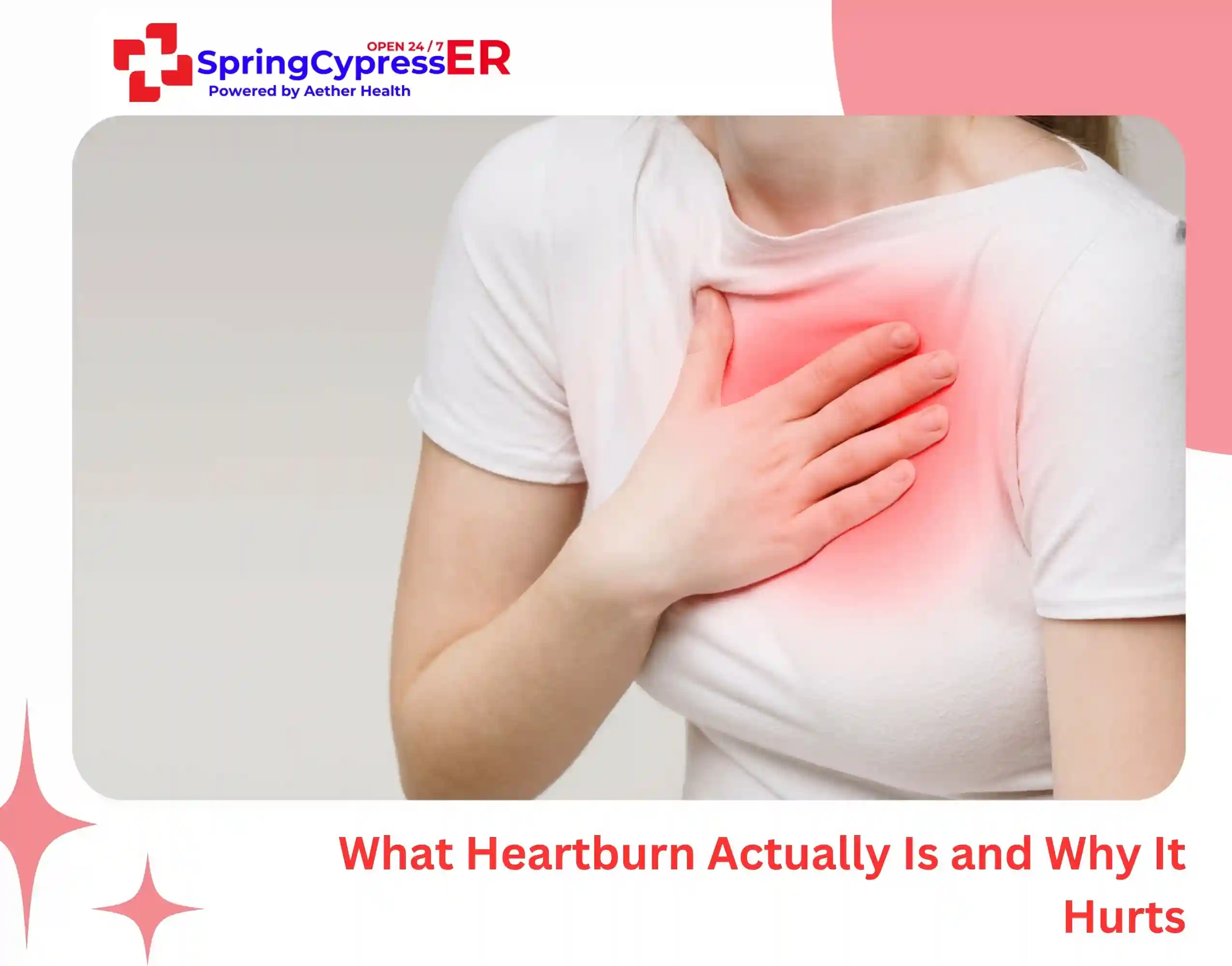What Heartburn Actually Is and Why It Hurts
