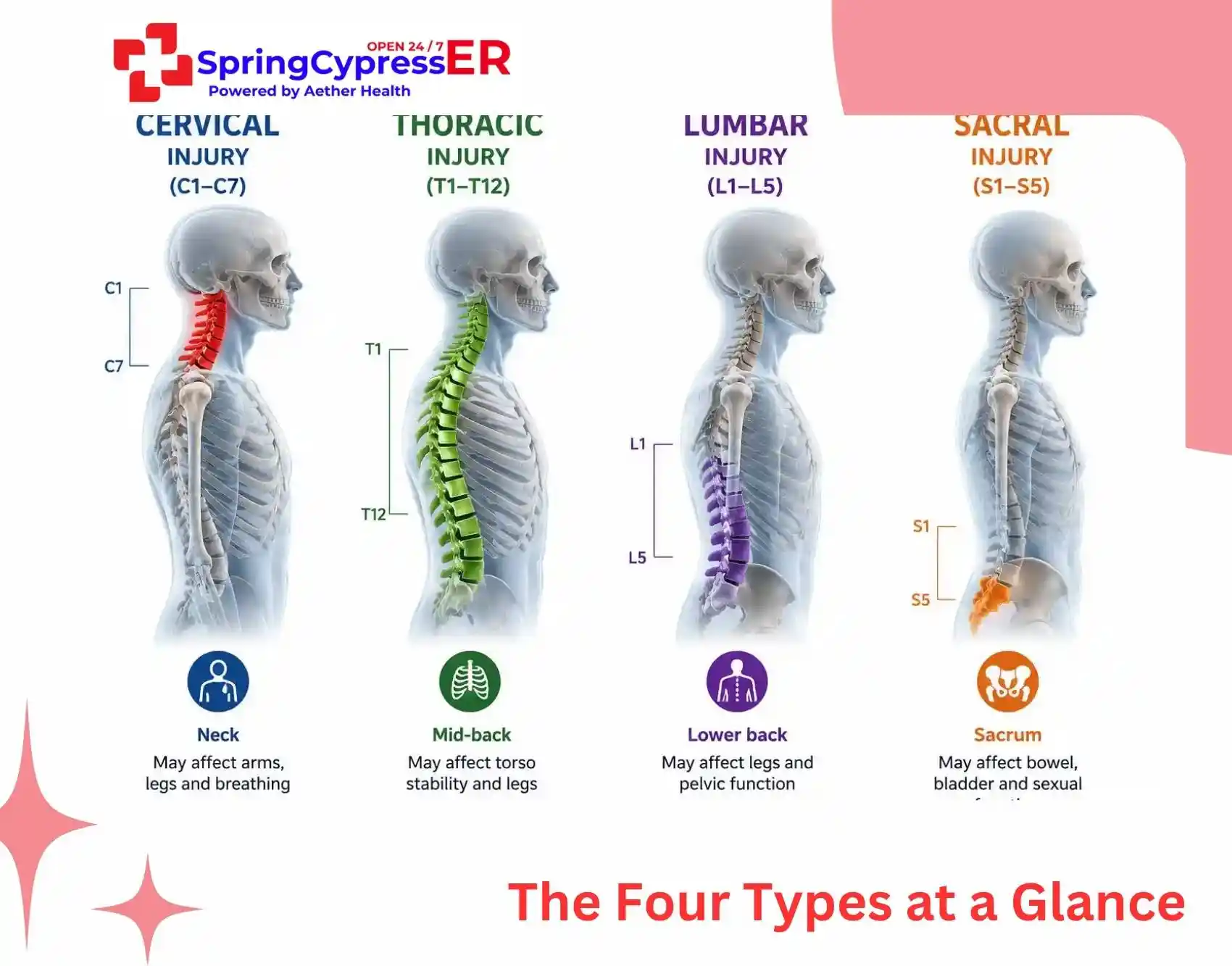 spinal injury classification chart