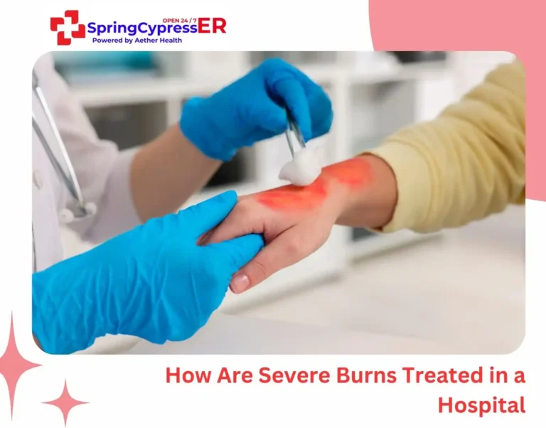 severe burn treatment Spring TX