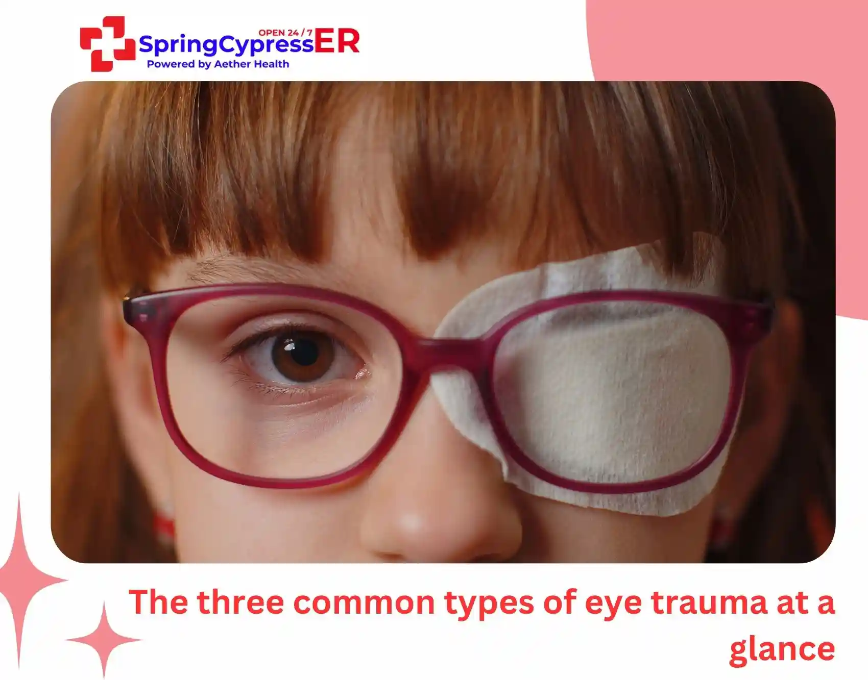 The three common types of eye trauma at a glance