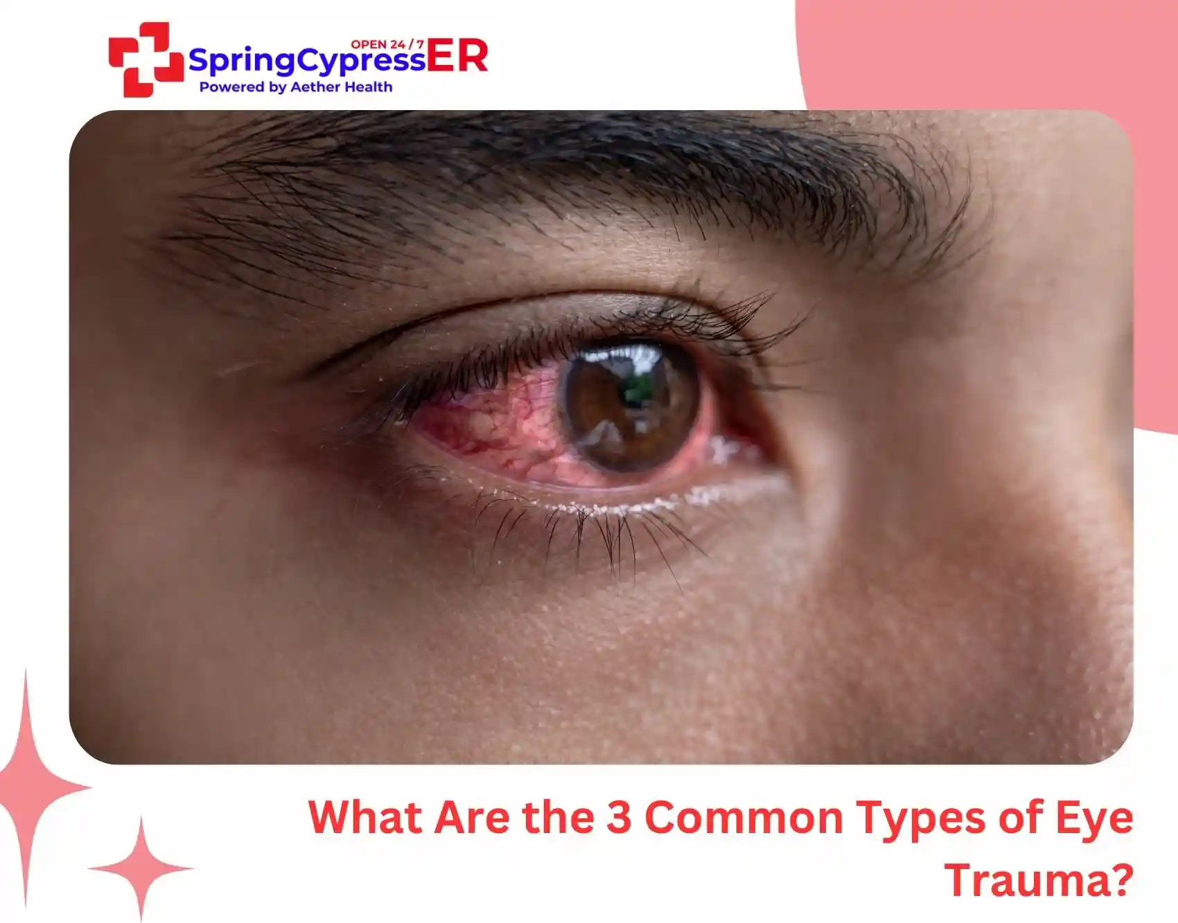 What Are the 3 Common Types of Eye Trauma