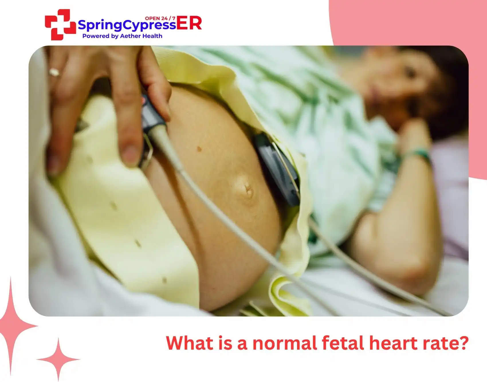 What is a normal fetal heart rate