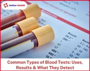 Common Types of Blood Tests Uses, Results & What They Detect