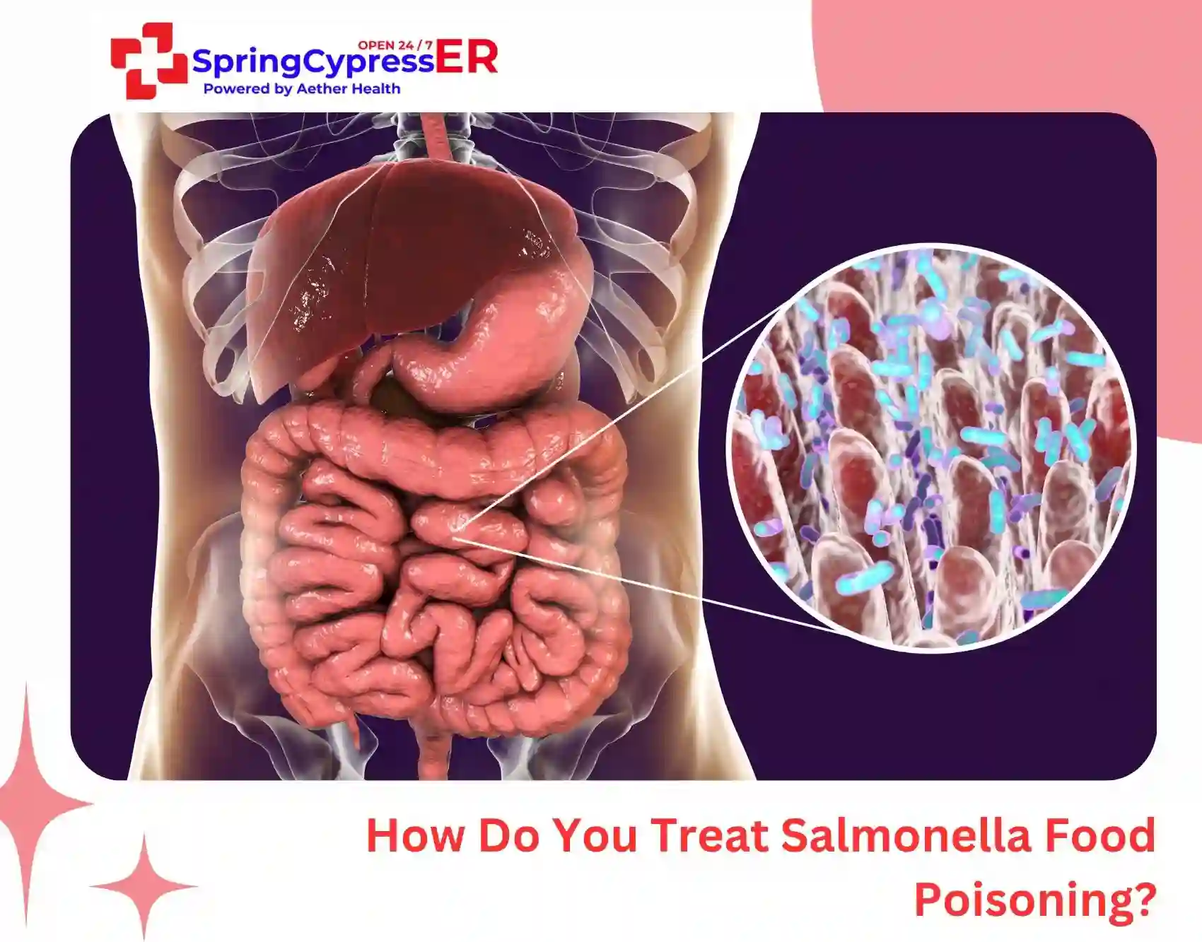 How Do You Treat Salmonella Food Poisoning