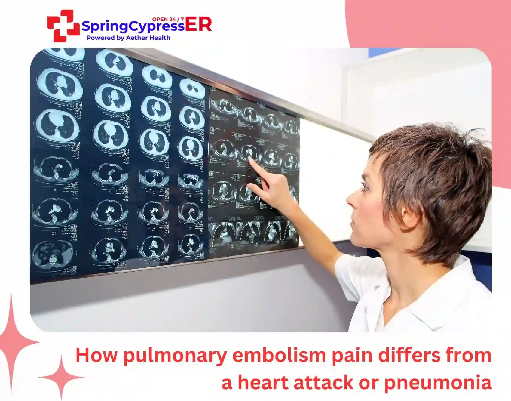 How pulmonary embolism pain differs from a heart attack or pneumonia