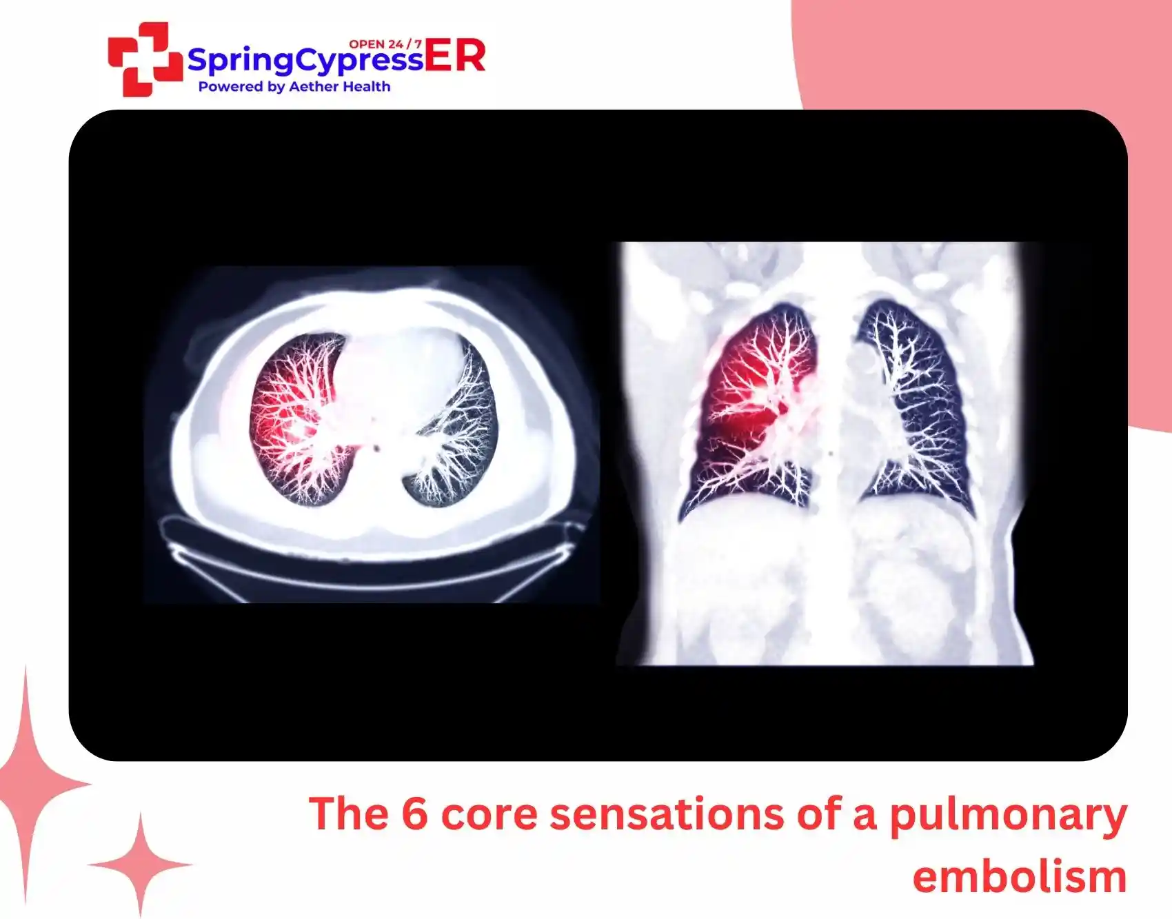 The 6 core sensations of a pulmonary embolism