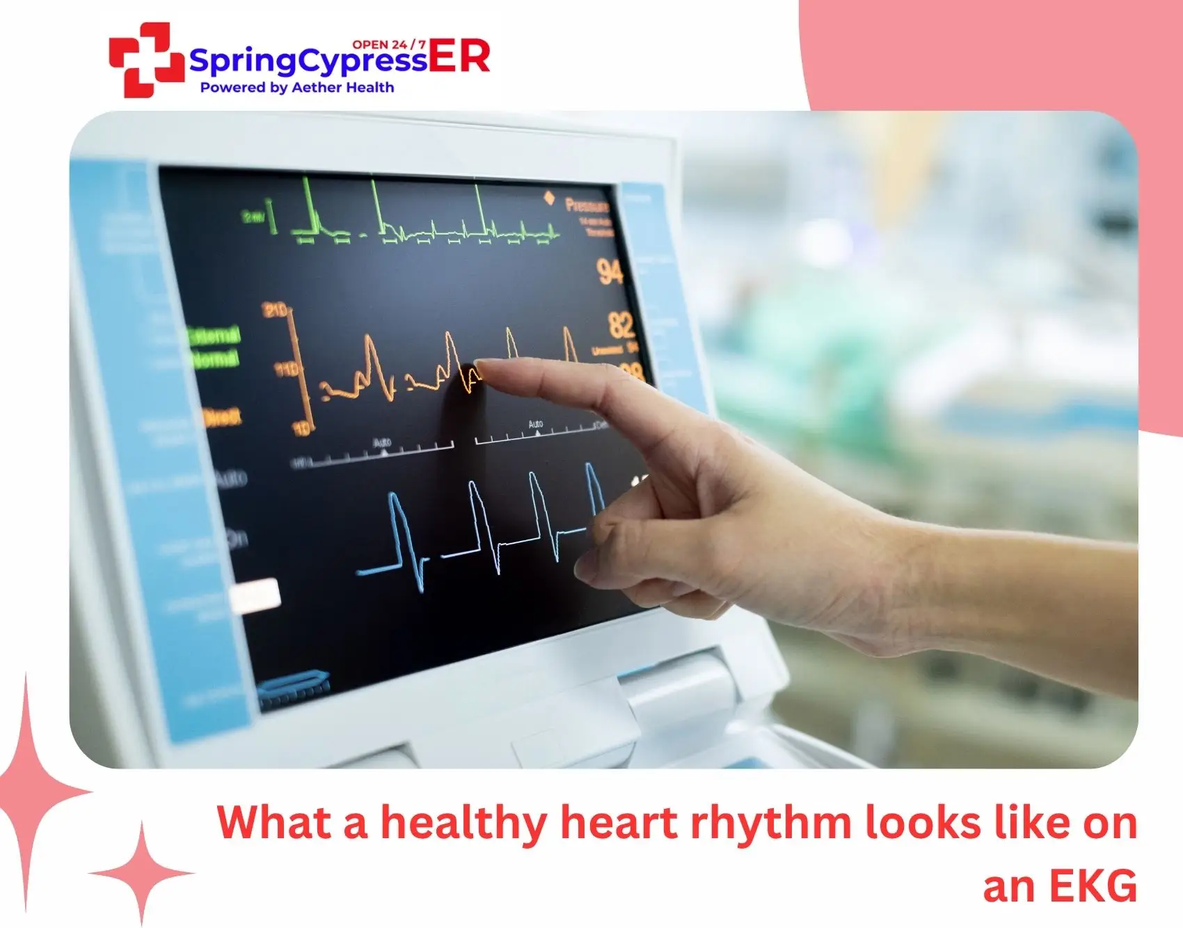What a healthy heart rhythm looks like on an EKG