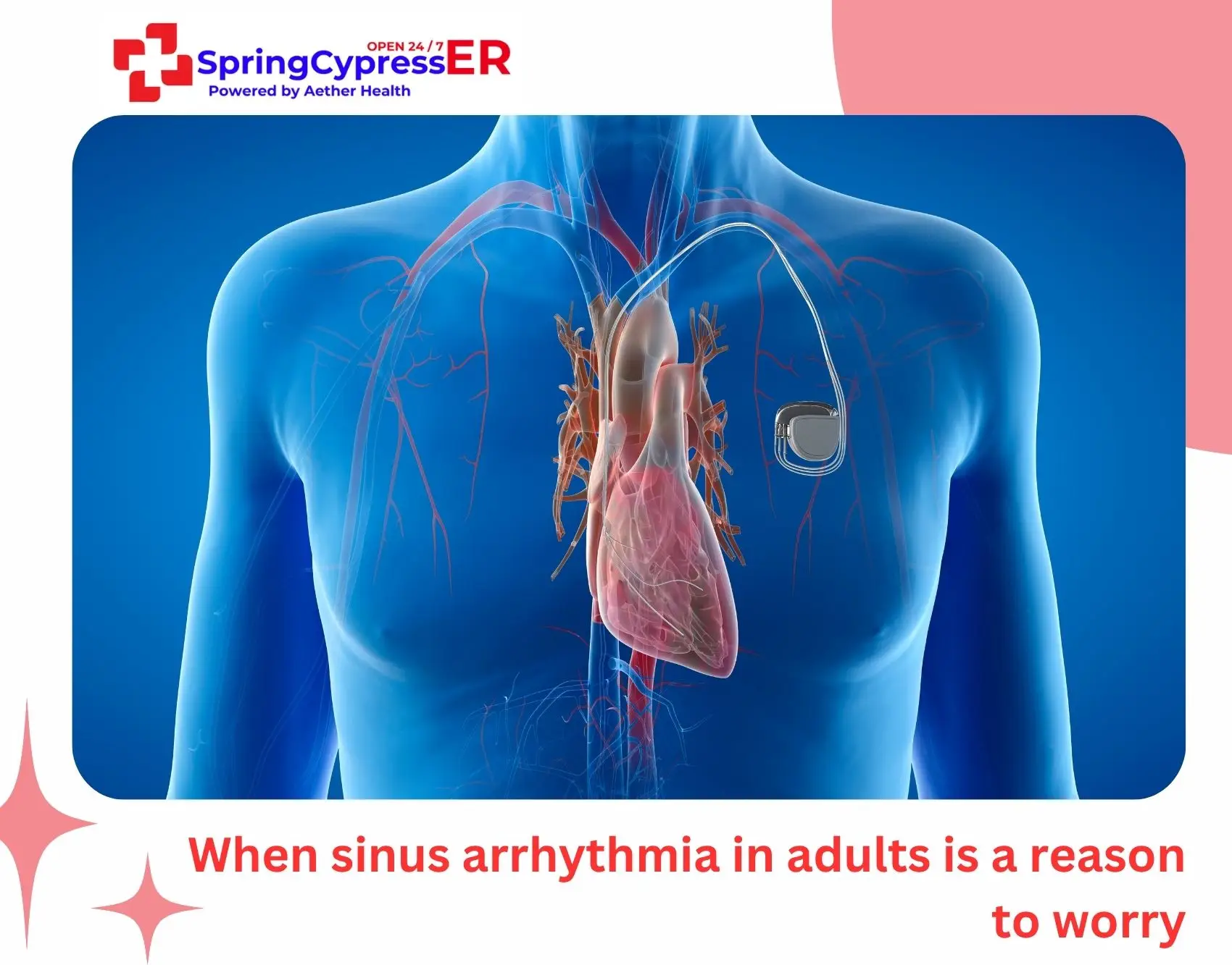 When sinus arrhythmia in adults is a reason to worry
